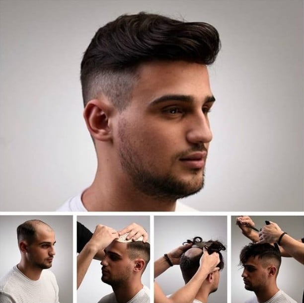 toupee for men